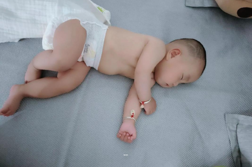 德宏宝宝突然很多眼屎
